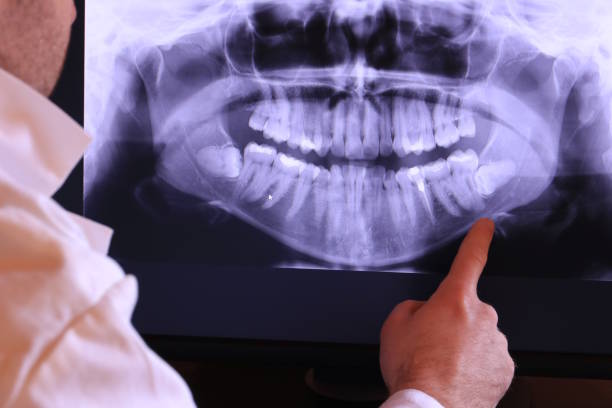 Best Knocked-Out Tooth Emergency  in Steelton, PA